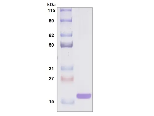 [MC05-100] Recombinant Human Galectin 7, His Tag -100 ug